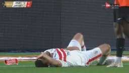 طبيب الزمالك يوضح حقيقة إصابة...